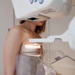 mamografija snimanje dojka dojenje