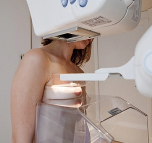 mamografija snimanje dojka dojenje