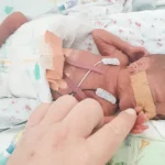 beba rođena prije vremena u inkubatoru