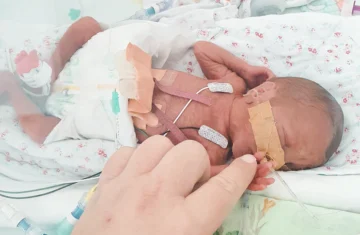 beba rođena prije vremena u inkubatoru