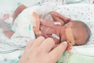 beba rođena prije vremena u inkubatoru