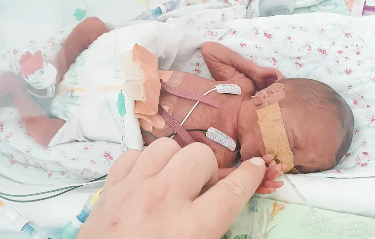 beba rođena prije vremena u inkubatoru