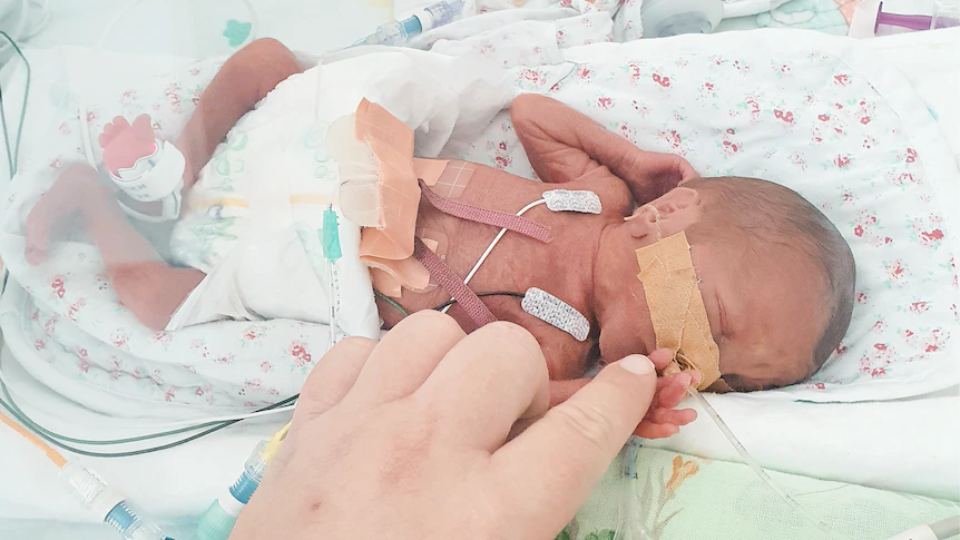 beba rođena prije vremena u inkubatoru