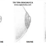 uvučene bradavice i dojenje