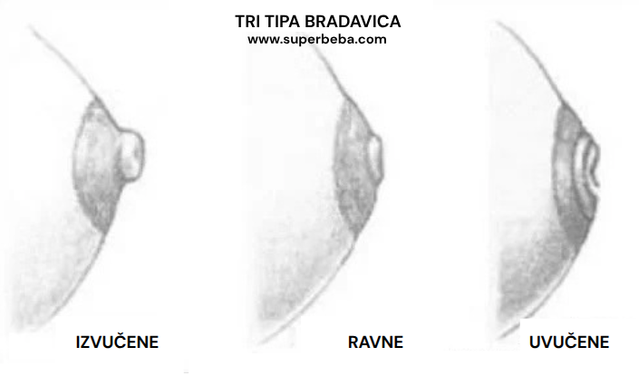 uvučene bradavice i dojenje